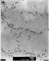 Cholera bacteria